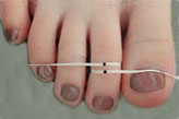 Use of dental floss to determine toe ring size